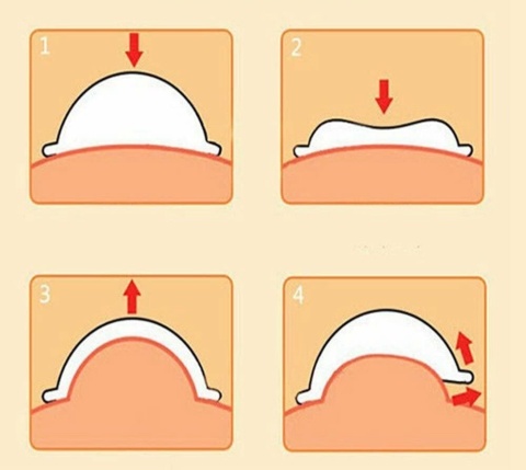 Bańki chińskie silikonowe próżniowe zestaw 4 sztuk do masażu ciała gumowe